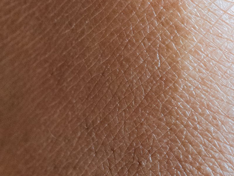 Close-up of skin texture