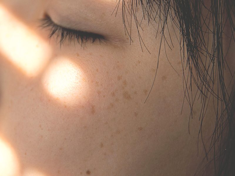 Close-up of a closed eye and freckled cheek with sun spots in soft window light